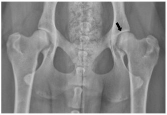 hip joint xray normal