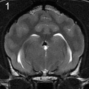 MRI Shoulder T1