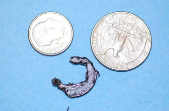 Coins removed via endoscope