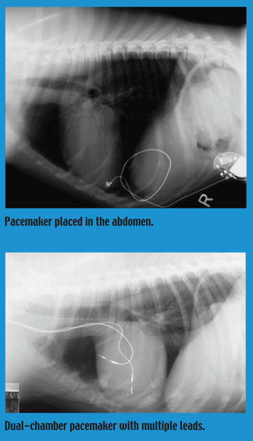 Pacemaker x-rays