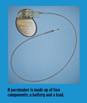 Pacemaker battery