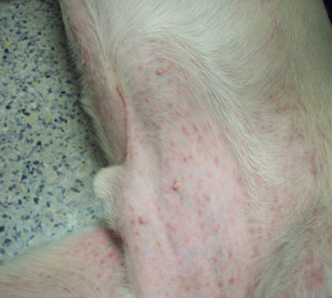 Bacterial skin infection