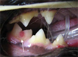 Stage 2 Lesions Teeth