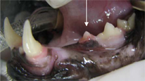 Stage 4 Lesions Teeth
