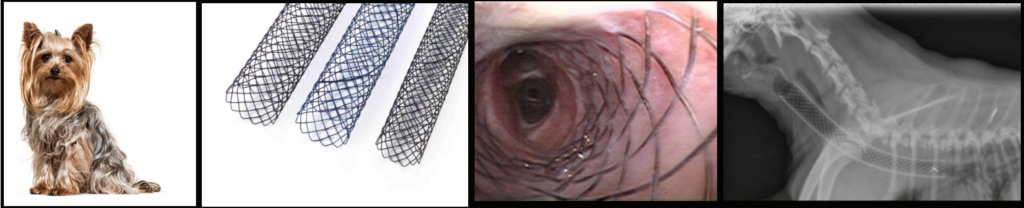 Tracheal stent placement